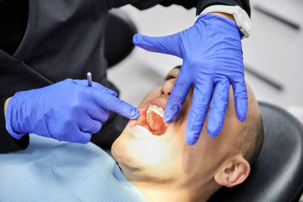Best Urgent Tooth Repair  in Kountze, TX