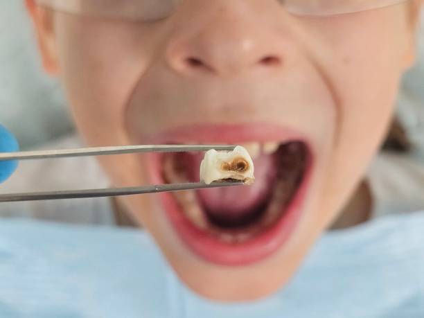 Best Teeth Whitening  in Kountze, TX
